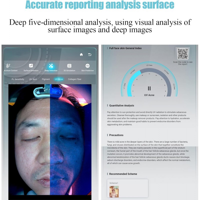 Skin Analyzer