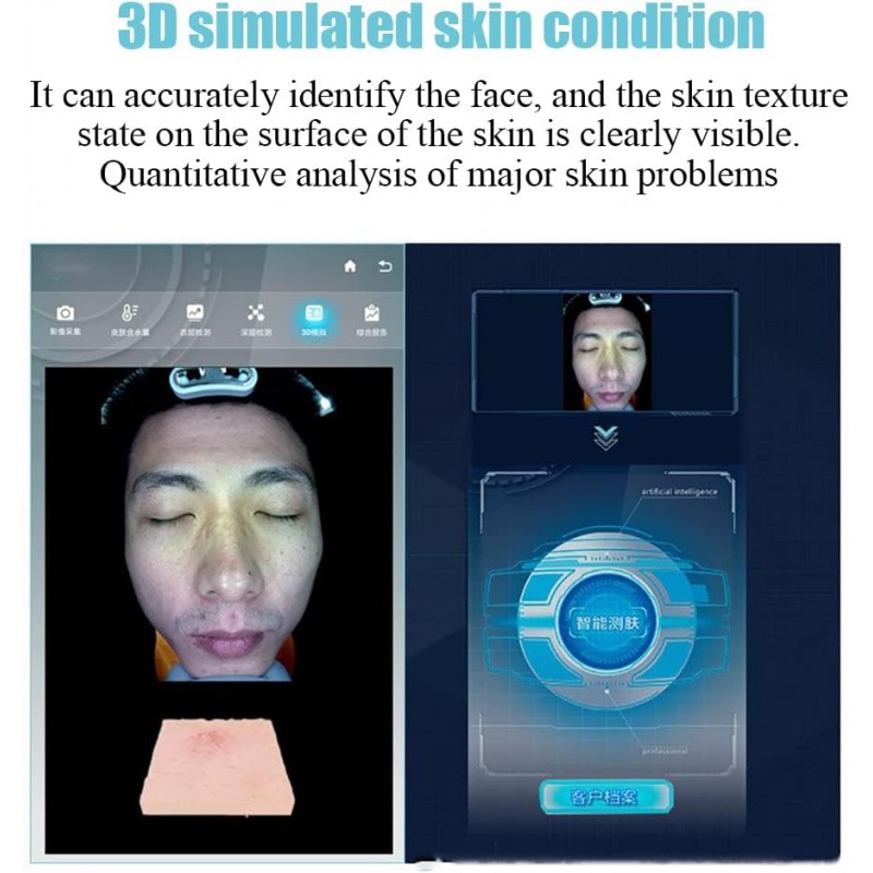 Skin Analyzer