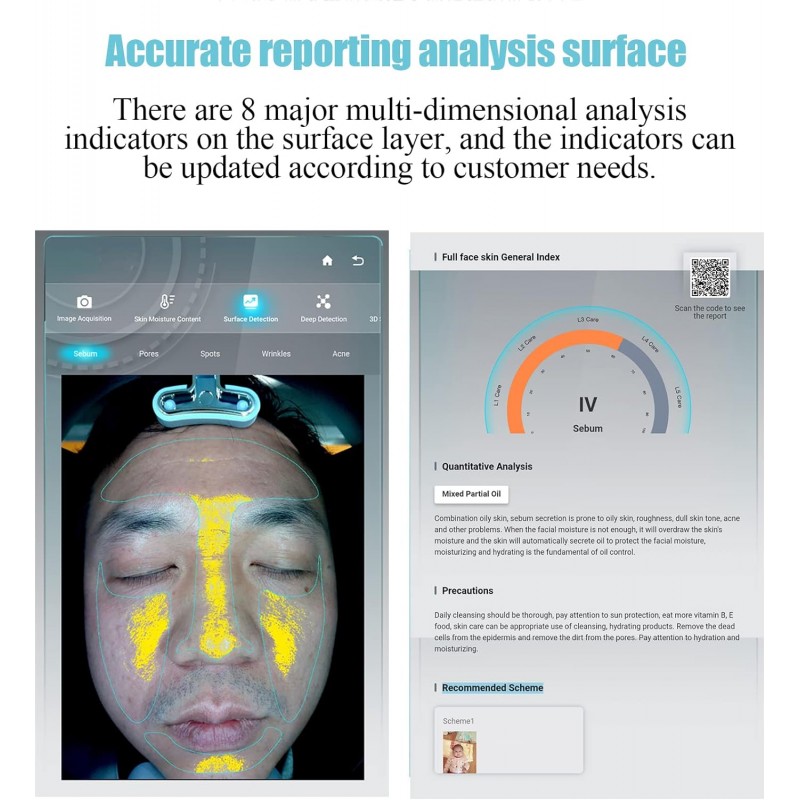 Skin Analyzer