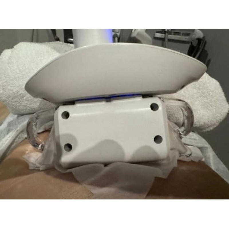 cryolipolysis antifreeze membrane