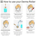 ZGTS Titanium Alloy 192 needle derma roller - Image 7