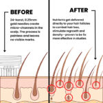 Dr Medsam hair regrowth microneedle serum for dermaroller - Image 10